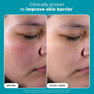 Paula's Choice  Skin Perfecting 2% BHA Liquid Exfoliant - 30ml