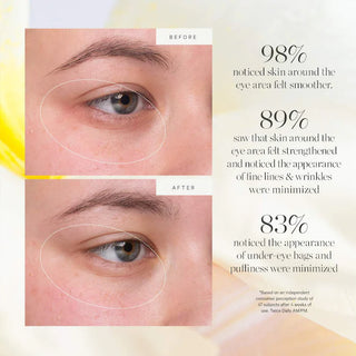KORA Organics Kakadu Plum Vitamin C Eye Cream 15ml - Jar