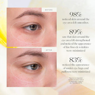 KORA Organics Kakadu Plum Vitamin C Eye Cream Refill - 15ml