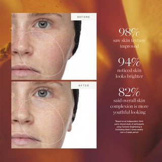 KORA Organics Turmeric Brightening & Exfoliating Mask