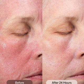 Revision Skincare CMT Post Procedure Cream