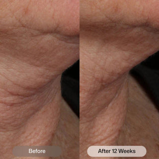 Revision Skincare Nectifirm Advanced Trial Size